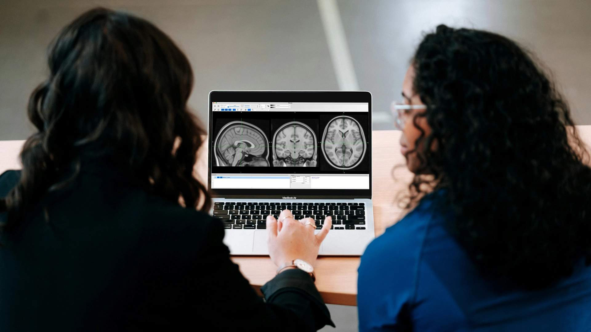 Nowy system AI z MIT przyspiesza i ułatwia segmentację obrazów